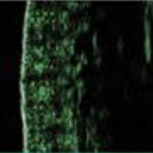 skin density before image