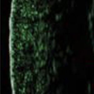 skin density after image