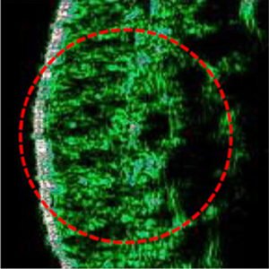 dermal tissue before image