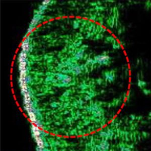 dermal tissue after image